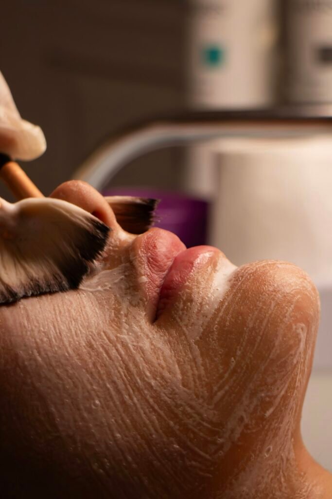 Chemical Peels treatment in Islamabad