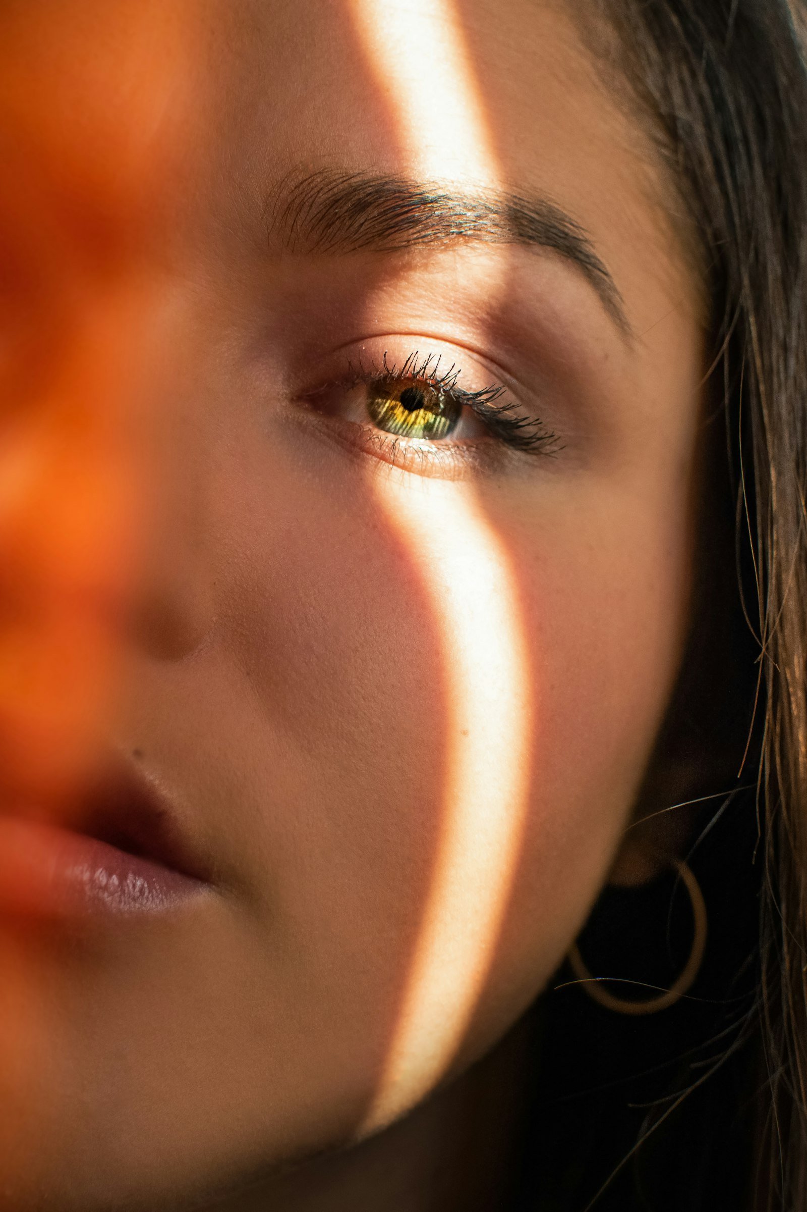 Pigmentation & Melasma Treatment in Islamabad: Causes, Options & Prevention